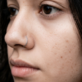 Twisted Nose Ring — 925 Sterling Silver | 8mm | 1mm Thick | Textured Everyday